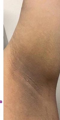 وایتنینگ تصویر1