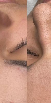 نگه داری صورت11