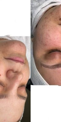 نگه داری صورت111