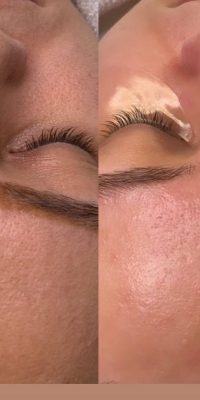 نگه داری صورت2